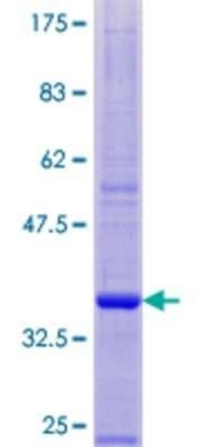 Novus Biologicals Recombinant Human Peptide YY GST (N-Term) Protein 10 &mu;g | Buy Online | Novus Biologicals&trade; | Fisher Scientific