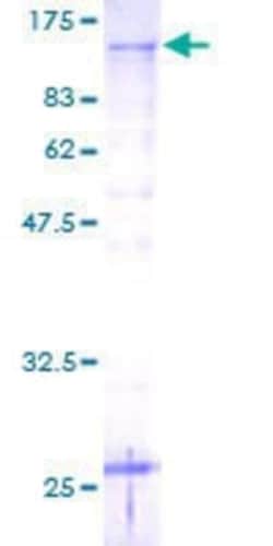 Novus Biologicals Recombinant Human Proteasome 19S 10B GST (N-Term) Protein 25 &mu;g | Buy Online | Novus Biologicals&trade; | Fisher Scientific