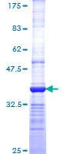 Novus Biologicals Recombinant Human Proteasome 19S S3 GST (N-Term) Protein 25 &mu;g | Buy Online | Novus Biologicals&trade; | Fisher Scientific