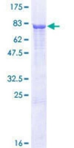 Novus Biologicals Recombinant Human PSMD12 GST (N-Term) Protein 25 &mu;g | Buy Online | Novus Biologicals&trade; | Fisher Scientific
