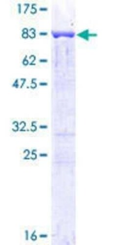 Novus Biologicals Recombinant Human PTBP1 GST (N-Term) Protein 25 &mu;g | Buy Online | Novus Biologicals&trade; | Fisher Scientific