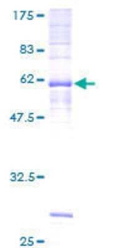 Novus Biologicals&trade;&nbsp;Recombinant Human PTGDR GST (N-Term) Protein