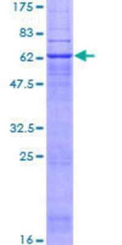 Novus Biologicals Recombinant Human PTGER2 GST (N-Term) Protein 10 &mu;g | Buy Online | Novus Biologicals&trade; | Fisher Scientific