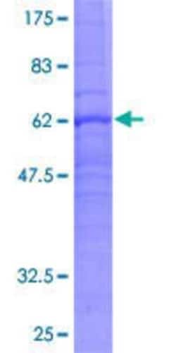 Novus Biologicals Recombinant Human PTGER3 GST (N-Term) Protein 25 &mu;g | Buy Online | Novus Biologicals&trade; | Fisher Scientific