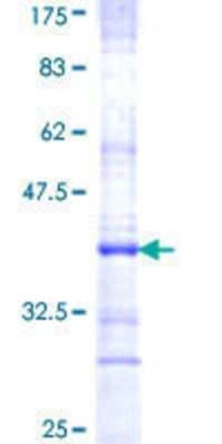Novus Biologicals Recombinant Human PTGER3 GST (N-Term) Protein 25 &mu;g | Buy Online | Novus Biologicals&trade; | Fisher Scientific