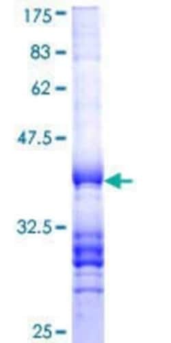 Novus Biologicals Recombinant Human PTGER4/EP4 GST (N-Term) Protein 25 &mu;g | Buy Online | Novus Biologicals&trade; | Fisher Scientific