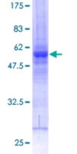 Novus Biologicals Recombinant Human PTP-MEG2/PTPN9 GST (N-Term) Protein 10 &mu;g | Buy Online | Novus Biologicals&trade; | Fisher Scientific