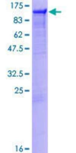 Novus Biologicals Recombinant Human PTPN12 GST (N-Term) Protein 10 &mu;g | Buy Online | Novus Biologicals&trade; | Fisher Scientific