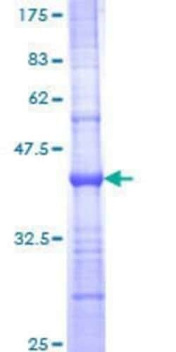 Novus Biologicals Recombinant Human PTPN13/PTPL1 GST (N-Term) Protein 10 &mu;g | Buy Online | Novus Biologicals&trade; | Fisher Scientific