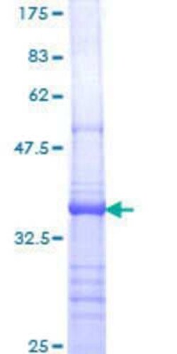 Novus Biologicals Recombinant Human PTP epsilon GST (N-Term) Protein 10 &mu;g | Buy Online | Novus Biologicals&trade; | Fisher Scientific