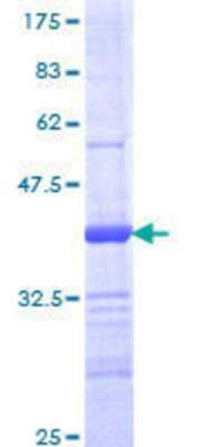 Novus Biologicals Recombinant Human PTP mu/PTPRM GST (N-Term) Protein 10 &mu;g | Buy Online | Novus Biologicals&trade; | Fisher Scientific