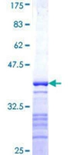 Novus Biologicals Recombinant Human IA-2/PTPRN GST (N-Term) Protein 25 &mu;g | Buy Online | Novus Biologicals&trade; | Fisher Scientific
