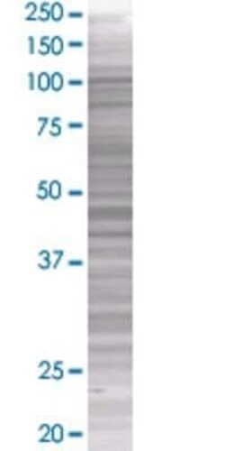 Novus Biologicals IA-2/PTPRN 293T Cell Transient Overexpression Lysate 0.1 mL | Buy Online | Novus Biologicals&trade; | Fisher Scientific
