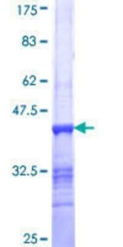 Novus Biologicals Recombinant Human PTPRN2 GST (N-Term) Protein 10 &mu;g | Buy Online | Novus Biologicals&trade; | Fisher Scientific