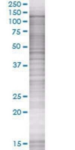 Novus Biologicals PTPRN2 293T Cell Transient Overexpression Lysate 0.1 mL | Buy Online | Novus Biologicals&trade; | Fisher Scientific