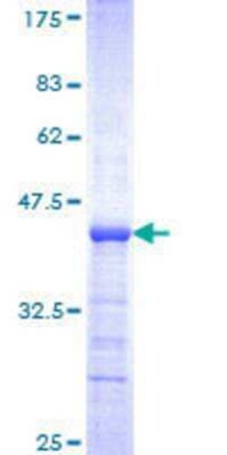 Novus Biologicals Recombinant Human PURA GST (N-Term) Protein 10 &mu;g | Buy Online | Novus Biologicals&trade; | Fisher Scientific