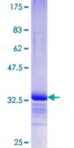 Novus Biologicals Recombinant Human PURA GST (N-Term) Protein 10 &mu;g | Buy Online | Novus Biologicals&trade; | Fisher Scientific