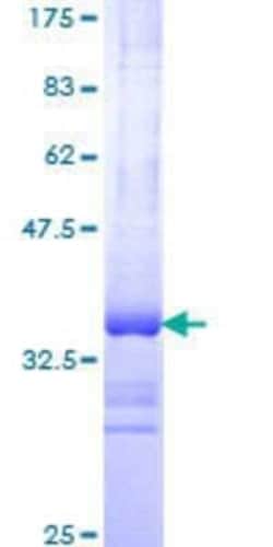 Novus Biologicals Recombinant Human PXMP3 GST (N-Term) Protein 10 &mu;g | Buy Online | Novus Biologicals&trade; | Fisher Scientific