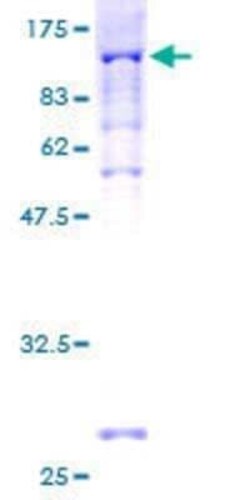 Novus Biologicals Recombinant Human PEX5 GST (N-Term) Protein 2 &mu;g | Buy Online | Novus Biologicals&trade; | Fisher Scientific