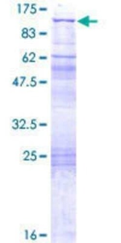 Novus Biologicals Recombinant Human QARS GST (N-Term) Protein 2 &mu;g | Buy Online | Novus Biologicals&trade; | Fisher Scientific