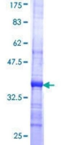 Novus Biologicals Recombinant Human QARS GST (N-Term) Protein 10 &mu;g | Buy Online | Novus Biologicals&trade; | Fisher Scientific