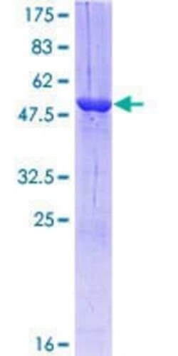 Novus Biologicals Recombinant Human Rab3A GST (N-Term) Protein 25 &mu;g | Buy Online | Novus Biologicals&trade; | Fisher Scientific