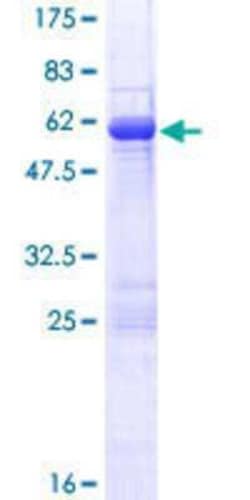 Novus Biologicals Recombinant Human RABGGTB GST (N-Term) Protein 10 &mu;g | Buy Online | Novus Biologicals&trade; | Fisher Scientific