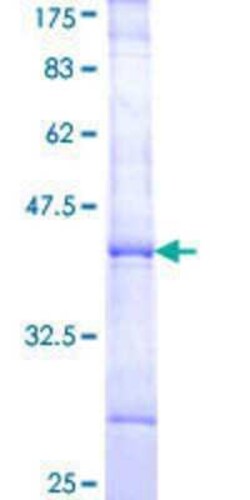 Novus Biologicals Recombinant Human Rad9 GST (N-Term) Protein 25 &mu;g | Buy Online | Novus Biologicals&trade; | Fisher Scientific
