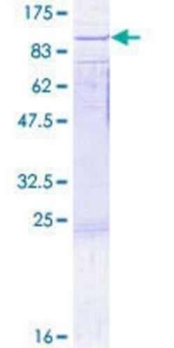 Novus Biologicals Recombinant Human Rad17 GST (N-Term) Protein 2 &mu;g | Buy Online | Novus Biologicals&trade; | Fisher Scientific