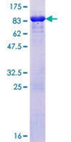 Novus Biologicals Recombinant Human Rad23 GST (N-Term) Protein 25 &mu;g | Buy Online | Novus Biologicals&trade; | Fisher Scientific