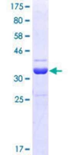 Novus Biologicals Recombinant Human hHR23b GST (N-Term) Protein 10 &mu;g | Buy Online | Novus Biologicals&trade; | Fisher Scientific