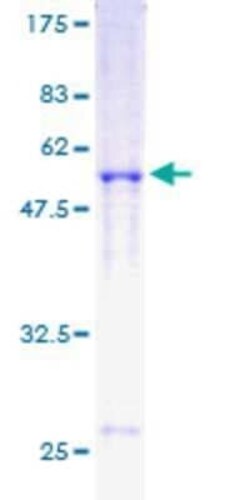 Novus Biologicals Recombinant Human Rad51 GST (N-Term) Protein 25 &mu;g | Buy Online | Novus Biologicals&trade; | Fisher Scientific