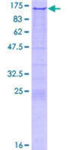 Novus Biologicals Recombinant Human RAG1 GST (N-Term) Protein 2 &mu;g | Buy Online | Novus Biologicals&trade; | Fisher Scientific