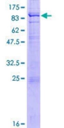 Novus Biologicals Recombinant Human RAG2 GST (N-Term) Protein 2 &mu;g | Buy Online | Novus Biologicals&trade; | Fisher Scientific