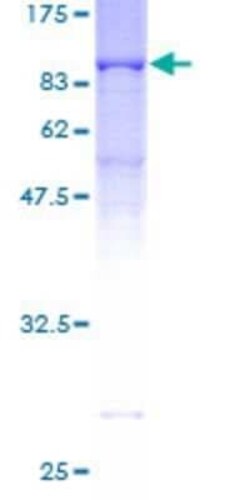 Novus Biologicals Recombinant Human RanGAP1 GST (N-Term) Protein 25 &mu;g | Buy Online | Novus Biologicals&trade; | Fisher Scientific