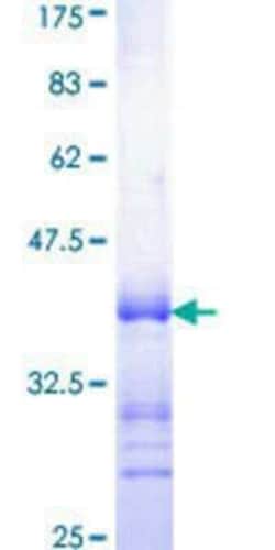 Novus Biologicals Recombinant Human RAR beta/NR1B2 GST (N-Term) Protein 25 &mu;g | Buy Online | Novus Biologicals&trade; | Fisher Scientific