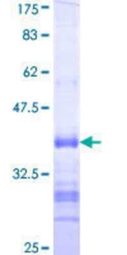 Novus Biologicals Recombinant Human RAR gamma/NR1B3 GST (N-Term) Protein 10 &mu;g | Buy Online | Novus Biologicals&trade; | Fisher Scientific