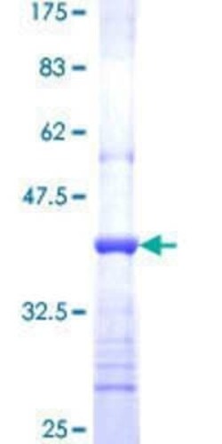 Novus Biologicals Recombinant Human RARRES3 GST (N-Term) Protein 10 &mu;g | Buy Online | Novus Biologicals&trade; | Fisher Scientific