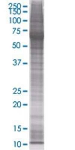 Novus Biologicals RARRES3 293T Cell Transient Overexpression Lysate 0.1 mL | Buy Online | Novus Biologicals&trade; | Fisher Scientific