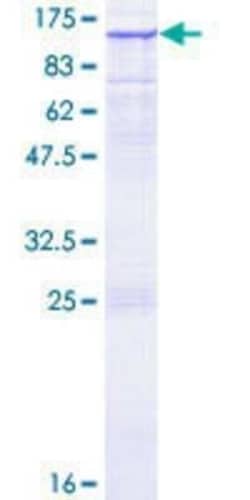 Novus Biologicals Recombinant Human Ras-GAP GST (N-Term) Protein 2 &mu;g | Buy Online | Novus Biologicals&trade; | Fisher Scientific