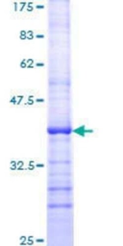 Novus Biologicals Recombinant Human RASGRF1 GST (N-Term) Protein 25 &mu;g | Buy Online | Novus Biologicals&trade; | Fisher Scientific