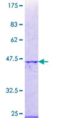 Novus Biologicals Recombinant Human RbBP5 GST (N-Term) Protein 25 &mu;g | Buy Online | Novus Biologicals&trade; | Fisher Scientific