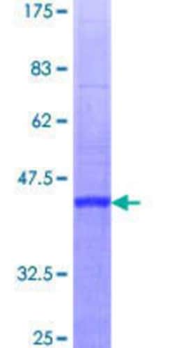 Novus Biologicals Recombinant Human RBBP6 GST (N-Term) Protein 25 &mu;g | Buy Online | Novus Biologicals&trade; | Fisher Scientific