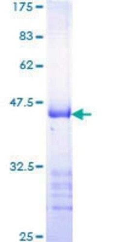 Novus Biologicals Recombinant Human RBBP6 GST (N-Term) Protein 10 &mu;g | Buy Online | Novus Biologicals&trade; | Fisher Scientific