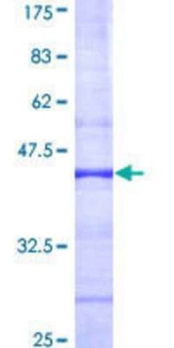 Novus Biologicals Recombinant Human p107 GST (N-Term) Protein 25 &mu;g | Buy Online | Novus Biologicals&trade; | Fisher Scientific