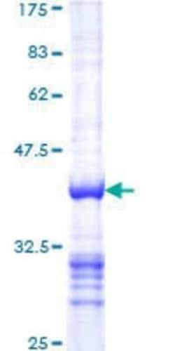Novus Biologicals Recombinant Human p130 GST (N-Term) Protein 25 &mu;g | Buy Online | Novus Biologicals&trade; | Fisher Scientific