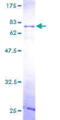 Novus Biologicals Recombinant Human RBMS1 GST (N-Term) Protein 25 &mu;g | Buy Online | Novus Biologicals&trade; | Fisher Scientific