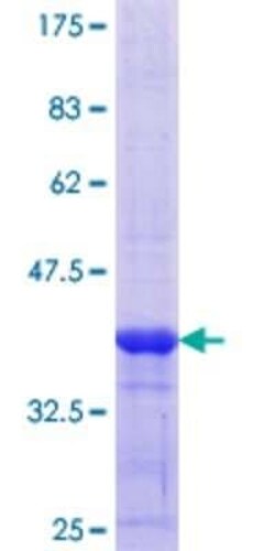 Novus Biologicals Recombinant Human RBMY1A1 GST (N-Term) Protein 25 &mu;g | Buy Online | Novus Biologicals&trade; | Fisher Scientific