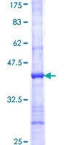 Novus Biologicals Recombinant Human RDH5 GST (N-Term) Protein 25 &mu;g | Buy Online | Novus Biologicals&trade; | Fisher Scientific