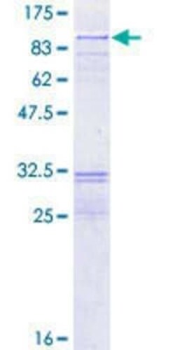 Novus Biologicals Recombinant Human RECQ1 GST (N-Term) Protein 2 &mu;g | Buy Online | Novus Biologicals&trade; | Fisher Scientific